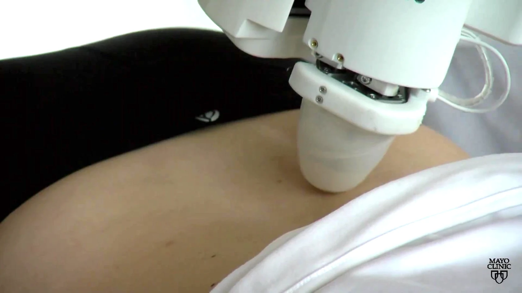 Close view of EMMA treatment head contacting a patient’s back